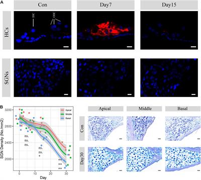 Tlr2/4 Double Knockout Attenuates the Degeneration of Primary Auditory Neurons: Potential Mechanisms From Transcriptomic Perspectives